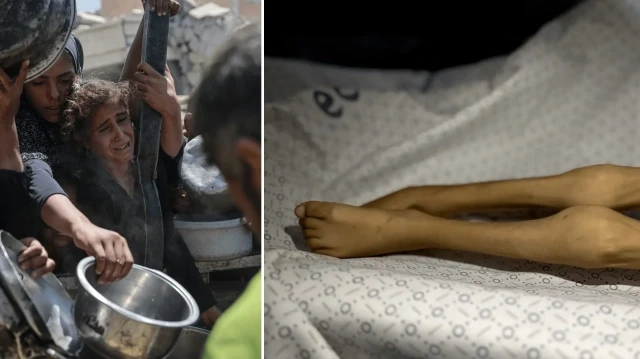 gazze saglik bakanligi kitlik ilan edilmesinden bu yana hicbir sey degismedi toplu olumler bekliyoruz 6u8PuczX