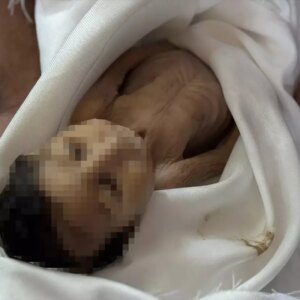 gazzede bebek aclikta hayatini kaybetti VFLkI7fm