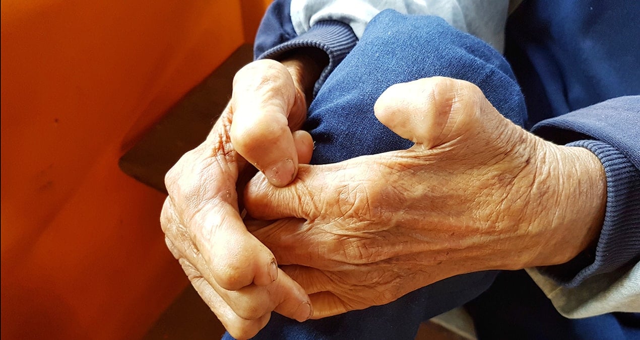 sadece kemikleriniz degil kaslariniz da erimesin u8VJK46x